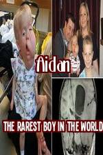 Watch Aidan The Rarest Boy In The World Tvmuse