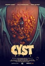 Watch Cyst Tvmuse