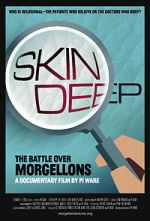 Watch Skin Deep: The Battle Over Morgellons Tvmuse