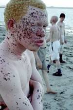 Watch Albino United Tvmuse