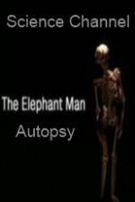 Watch Science Channel Elephant Man Autopsy Tvmuse
