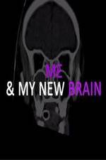Watch Me & My New Brain Tvmuse