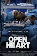 Watch Open Heart Tvmuse
