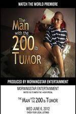 Watch The Man With The 200lb Tumor Tvmuse
