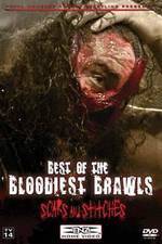 Watch TNA Wrestling: Best of the Bloodiest Brawls - Scars and Stitches Tvmuse