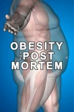 Watch Obesity: The Post Mortem Tvmuse