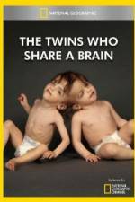 Watch National Geographic The Twins Who Share A Brain Tvmuse
