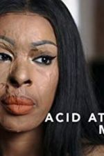 Watch Acid Attack: My Story Tvmuse