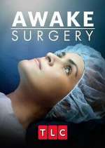 Watch Awake Surgery Tvmuse