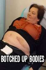 Watch Botched Up Bodies Tvmuse