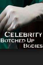 Watch Celebrity Botched Up Bodies Tvmuse